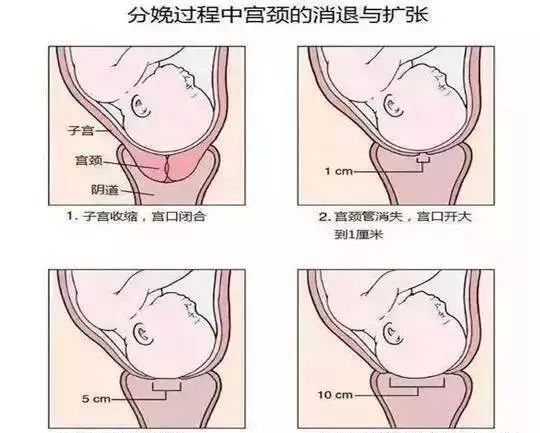 "开十指"是什么? 真要把10个手指塞进去才能生吗?